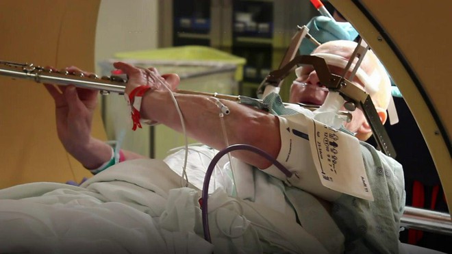 Mổ phanh não khi bệnh nhân vẫn đang tỉnh? Phương pháp nghe thì ghê rợn này ngày càng phổ biến và đây là lý do - Ảnh 1. Mổ phanh não khi bệnh nhân vẫn đang tỉnh? Phương pháp nghe thì ghê rợn này ngày càng phổ biến và đây là lý do - Ảnh 1.